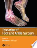 Essentials of Foot and Ankle Surgery Book