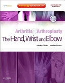 Arthritis and Arthroplasty