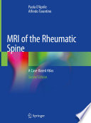 MRI of the Rheumatic Spine A Case-Based Atlas /