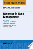 Advances in Acne Management  An Issue of Dermatologic Clinics  E Book