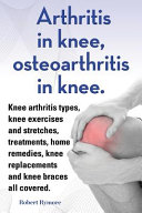 Arthritis in Knee  Osteoarthritis in Knee  Knee Arthritis Types  Knee Exercises and Stretches  Treatments  Home Remedies  Knee Replacements and Knee B