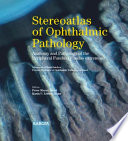 Stereoatlas of Ophthalmic Pathology Book