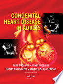 Congenital Heart Disease in Adults Book