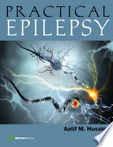 Practical Epilepsy Book
