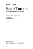 Brain Tumors Book
