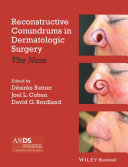 Read Pdf Reconstructive Conundrums in Dermatologic Surgery