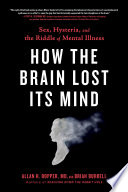 How the Brain Lost Its Mind