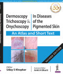 Dermoscopy, Trichoscopy and Onychoscopy in Diseases of the Pigmented Skin