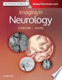 Imaging in Neurology E Book