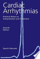 Cardiac Arrhythmias 7th Edition  Practical Notes on Interpretation and Treatment
