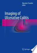 Imaging of Ulcerative Colitis Book