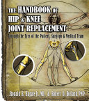 The Handbook of Hip & Knee Joint Replacement