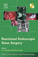 Functional Endoscopic Sinus Surgery - ECAB - E-Book