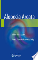 Alopecia Areata Book