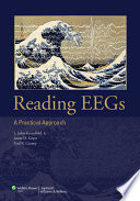 Reading Eegs A Practical Approach