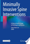 Minimally Invasive Spine Interventions Book