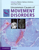 Uncommon Causes of Movement Disorders