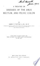 A Treatise on Diseases of the Anus  Rectum  and Pelvic Colon Book