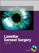 Lamellar Corneal Surgery