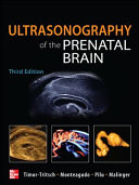 Ultrasonography of the Prenatal Brain, Third Edition