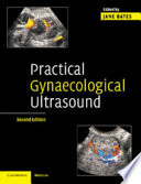 Practical Gynaecological Ultrasound Book