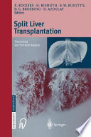 Split liver transplantation Book