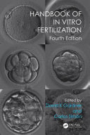 Handbook of in Vitro Fertilization Book