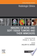 Imaging Of Bone And Soft Tissue Tumors And Their Mimickers An Issue Of Radiologic Clinics Of North America E Book