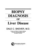 Biopsy Diagnosis of Liver Disease