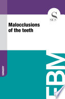 Malocclusions Of The Teeth