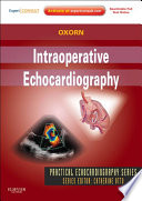 Intraoperative Echocardiography- E-BOOK