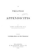 A Treatise on Appendicitis