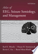 Atlas of EEG  Seizure Semiology  and Management