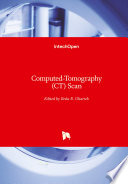 Computed Tomography  CT  Scan Book