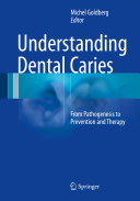 Understanding Dental Caries [Pdf/ePub] eBook