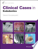 Clinical Cases in Endodontics Book