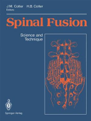 Spinal Fusion Book
