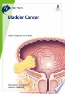 Fast Facts  Bladder Cancer