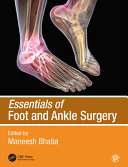 Essentials of foot and ankle surgery /
