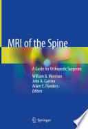 MRI of the Spine A Guide for Orthopedic Surgeons /