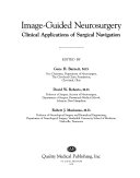 Image-guided Neurosurgery