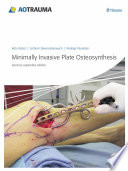 Minimally Invasive Plate Osteosynthesis  MIPO  Book PDF