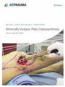 Minimally Invasive Plate Osteosynthesis (MIPO) [Pdf/ePub] eBook
