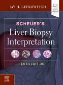 Scheuer s Liver Biopsy Interpretation Book