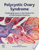 Book Polycystic Ovary Syndrome Cover
