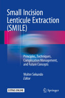 Small Incision Lenticule Extraction (SMILE)