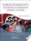 Farquharson s Textbook of Operative General Surgery