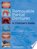 Removable Partial Dentures Book