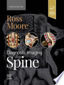 Diagnostic Imaging  Spine   E Book Book