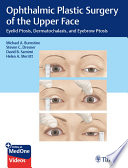 Ophthalmic Plastic Surgery of the Upper Face Book
